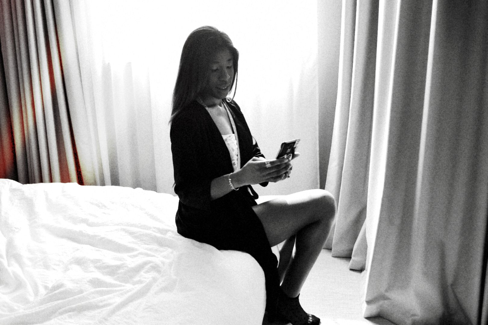 Cellulite and Orange Peel Skin: Causes, Types, and Proven Treatments for Smooth Results