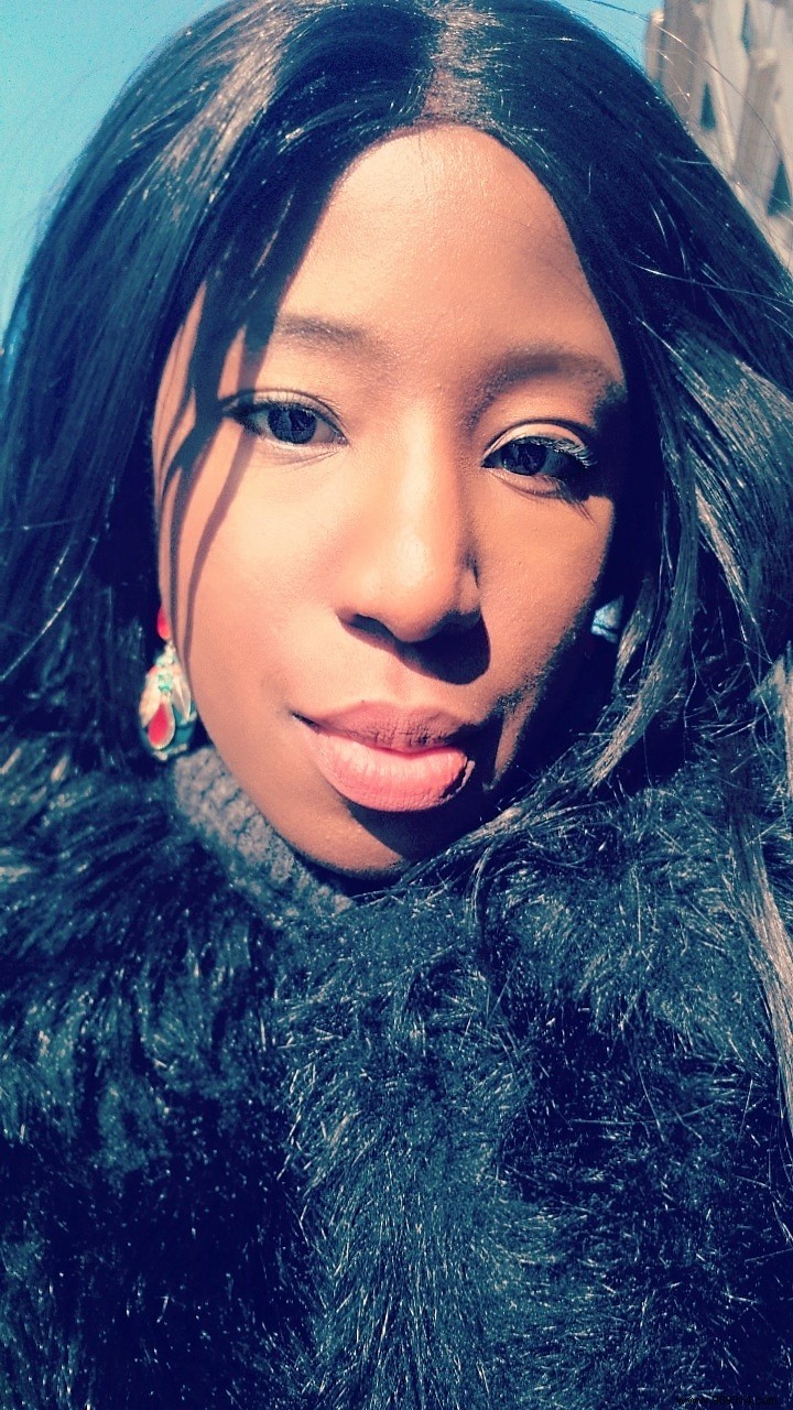 Sparkling Eyes: Expert Tips to Banish Dark Circles and Puffiness