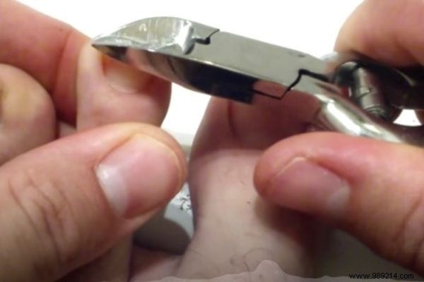 Podiatrist-Approved Technique: Cut Toenails Square to Prevent Painful Ingrowns