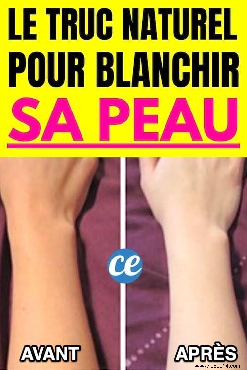 Achieve Radiant, Even Skin Naturally: The Proven Lemon Juice Method