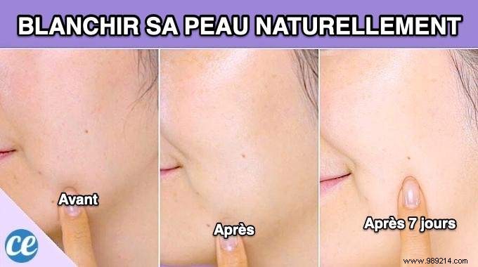 Achieve Radiant, Even Skin Naturally: The Proven Lemon Juice Method