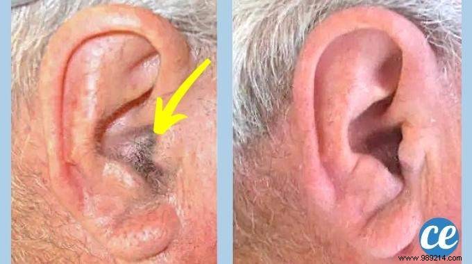 Proven Ways to Safely Remove Ear Hair: Tips from Years of Personal Experience