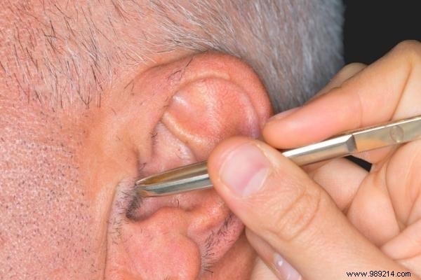 Proven Ways to Safely Remove Ear Hair: Tips from Years of Personal Experience