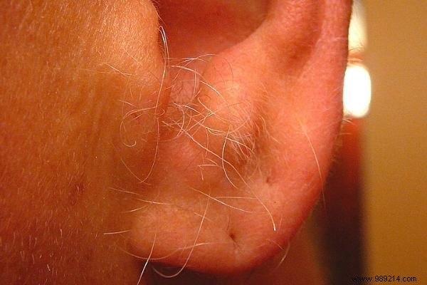 Proven Ways to Safely Remove Ear Hair: Tips from Years of Personal Experience