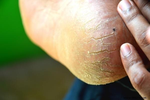 20 Proven Olive Oil Uses for Beauty, Home, Clothes, and Pets