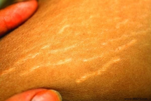 20 Proven Olive Oil Uses for Beauty, Home, Clothes, and Pets