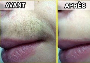 10 Proven Tips for Upper Lip Hair Removal: Painless and Effective Methods