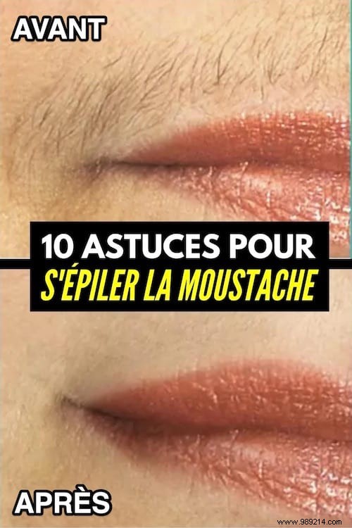 10 Proven Tips for Upper Lip Hair Removal: Painless and Effective Methods