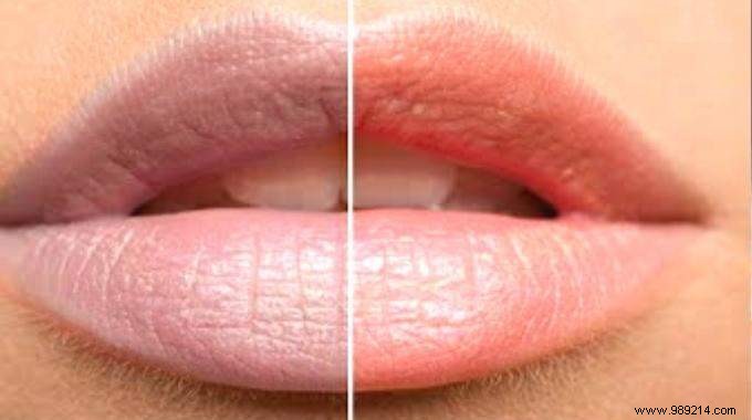 Lighten Tobacco-Stained Lips: 3 Proven Natural Remedies for Results in 1 Week