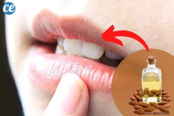 Lighten Tobacco-Stained Lips: 3 Proven Natural Remedies for Results in 1 Week