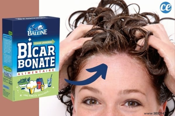 5 Proven Benefits of Baking Soda for Hair: Insights from a Professional Hairdresser