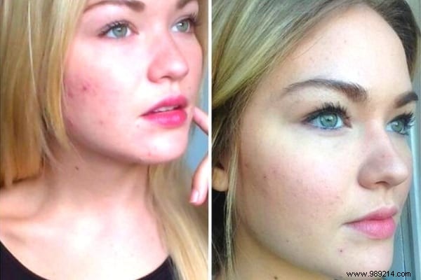 10 Proven Natural Beauty Tips for Radiant Face, Body, and Hair