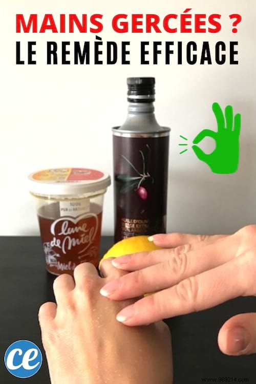 Heal Chapped Hands Fast: Grandma s Proven Natural Remedy