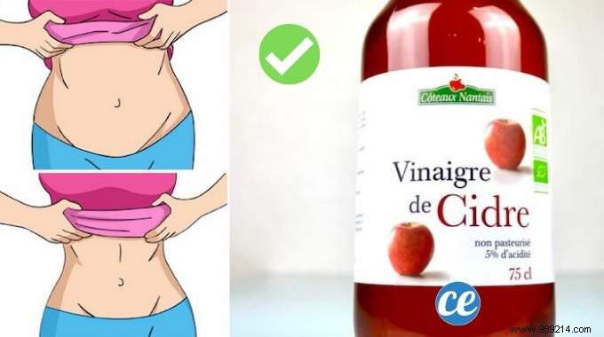 Dietitian-Recommended Tip: Lose Weight Naturally with Apple Cider Vinegar – No Dieting Required