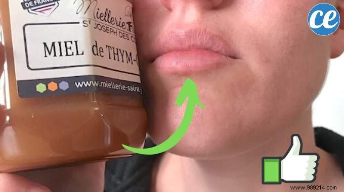 Heal Chapped Lips Overnight: A Proven Natural Honey Remedy