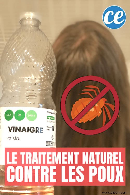Proven Natural Lice Treatment: White Vinegar Method for Fast Relief