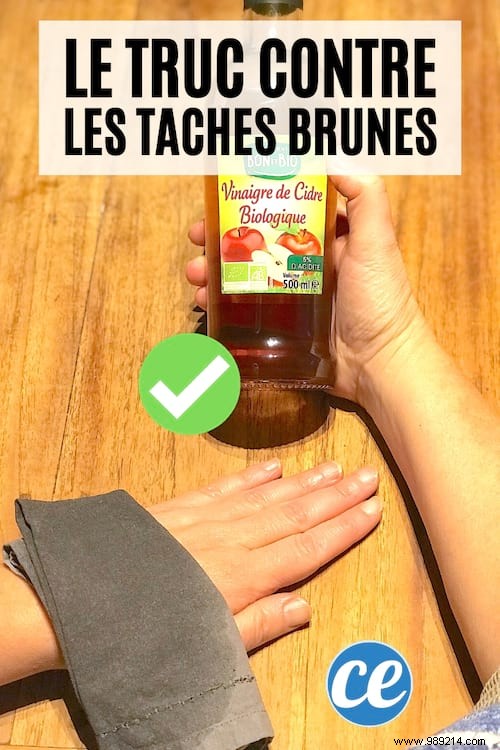 Fade Age Spots Naturally: Grandma s Time-Tested Apple Cider Vinegar Remedy