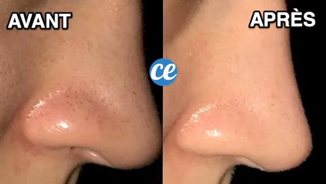 12 Proven Baking Soda Beauty Hacks for Glowing Skin, Hair, and Nails