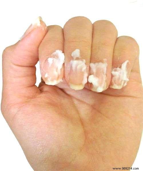 12 Proven Baking Soda Beauty Hacks for Glowing Skin, Hair, and Nails