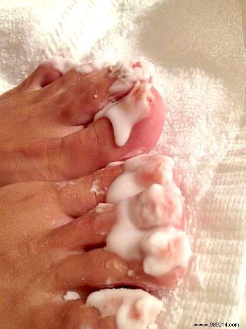 12 Proven Baking Soda Beauty Hacks for Glowing Skin, Hair, and Nails