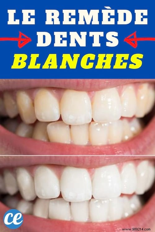 Natural Teeth Whitening: Brush with Diatomaceous Earth for Quick, Effective Results