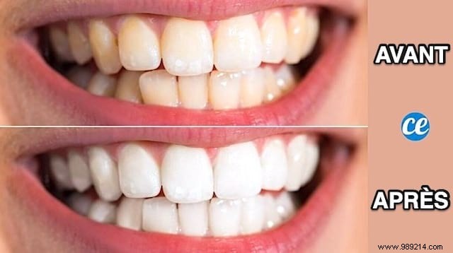 Natural Teeth Whitening: Brush with Diatomaceous Earth for Quick, Effective Results