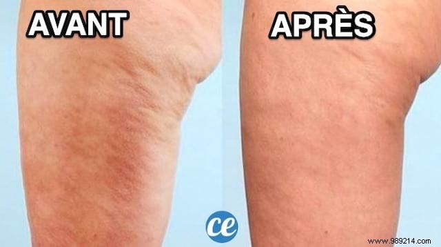 Grandma s Proven Natural Cellulite Scrub: My Real Results After Years of Trying Everything