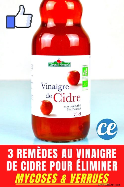 3 Proven Apple Cider Vinegar Remedies That Banish Fungal Infections and Warts