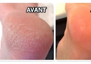 7 Proven Natural Remedies for Soft, Smooth Feet