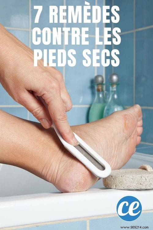 7 Proven Natural Remedies for Soft, Smooth Feet