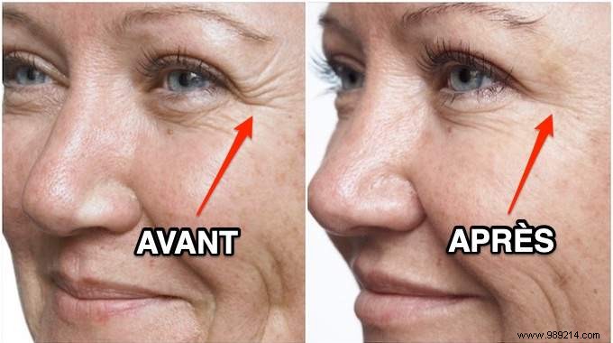 6 Natural Kitchen Remedies to Reduce Wrinkles Effectively