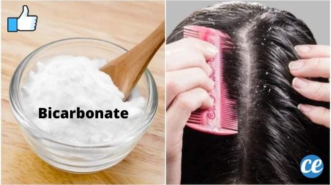 Banish Dandruff Naturally: The Proven Baking Soda Shampoo Hack