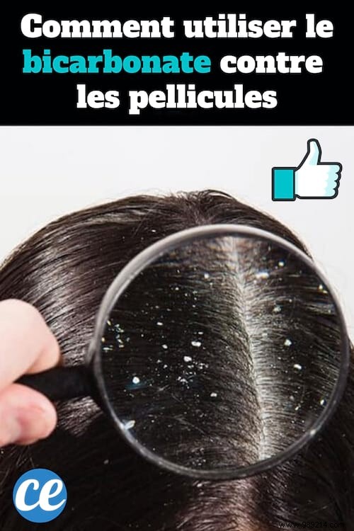 Banish Dandruff Naturally: The Proven Baking Soda Shampoo Hack