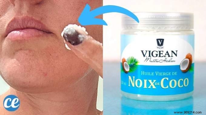 Coconut Oil for Skin and Face: 13 Proven Benefits and Expert Usage Tips