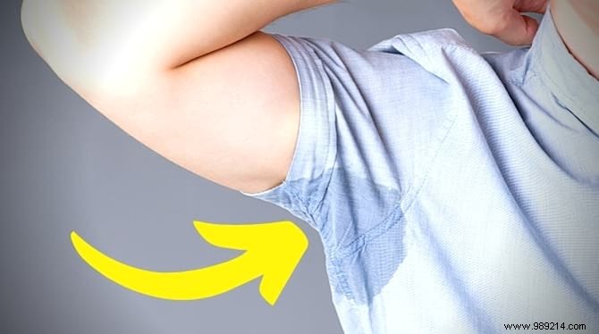 Stop Excessive Armpit Sweating Naturally: Proven Aloe Vera Remedy