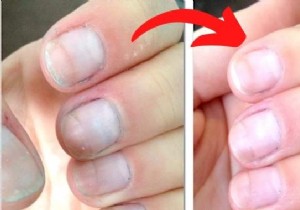 How to Instantly Whiten Yellowed Nails with Baking Soda: A Proven Natural Remedy