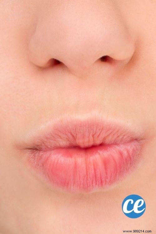 12 Natural Ways to Achieve Fuller Lips Without Surgery or Injections