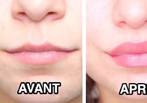 12 Natural Ways to Achieve Fuller Lips Without Surgery or Injections