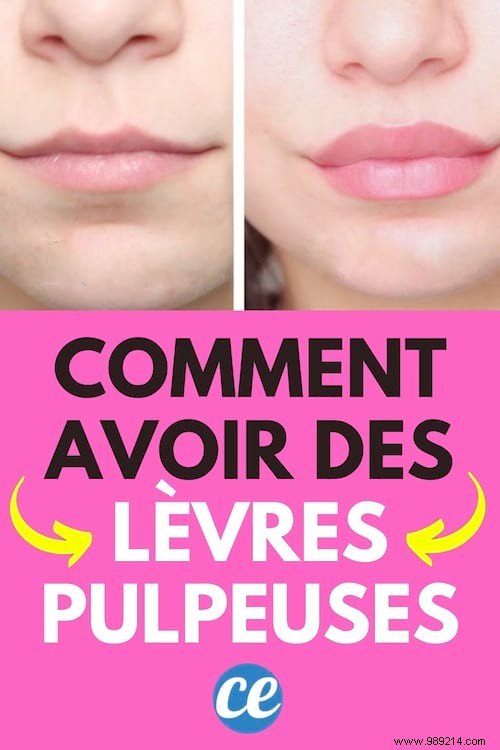 12 Natural Ways to Achieve Fuller Lips Without Surgery or Injections