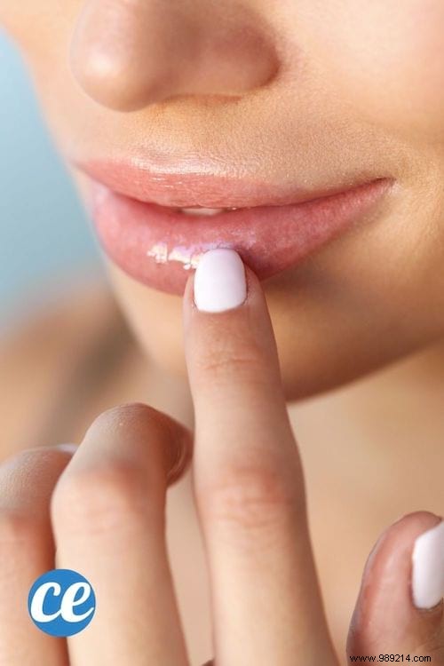 12 Natural Ways to Achieve Fuller Lips Without Surgery or Injections