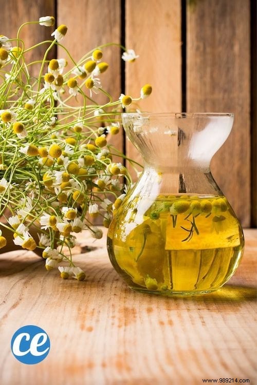 12 Natural Ways to Achieve Fuller Lips Without Surgery or Injections