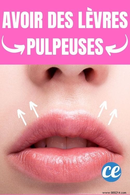 12 Natural Ways to Achieve Fuller Lips Without Surgery or Injections