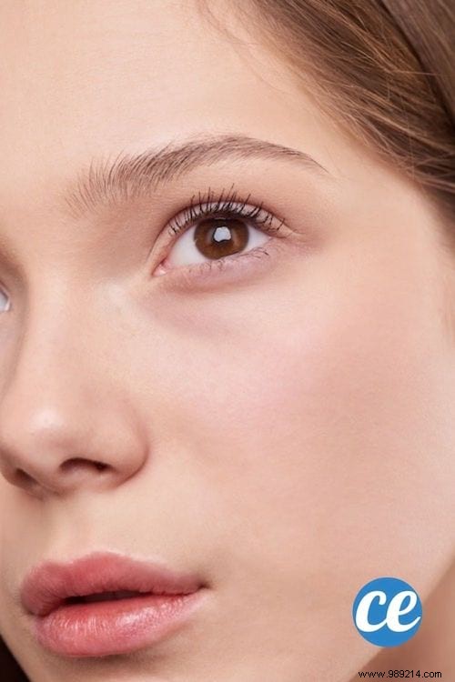 12 Natural Ways to Achieve Fuller Lips Without Surgery or Injections