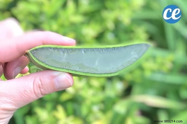 11 Proven Grandma s Remedies to Erase Dark Circles Under Eyes Quickly