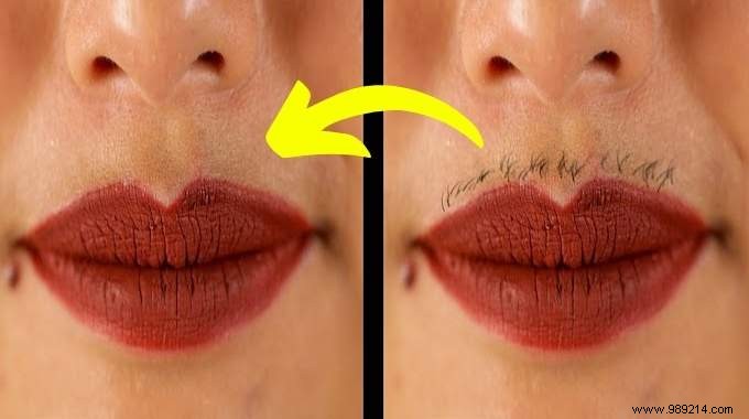 6 Time-Tested Grandma s Recipes for Naturally Bleaching Facial Hair