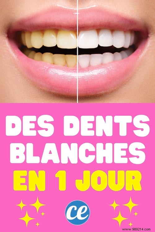 Natural Teeth Whitening in Just 1 Day: My Baking Soda and Hydrogen Peroxide Method