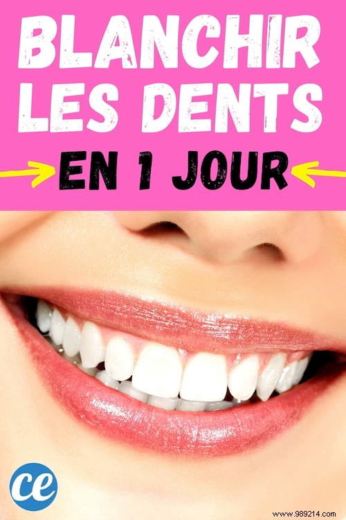 Natural Teeth Whitening in Just 1 Day: My Baking Soda and Hydrogen Peroxide Method