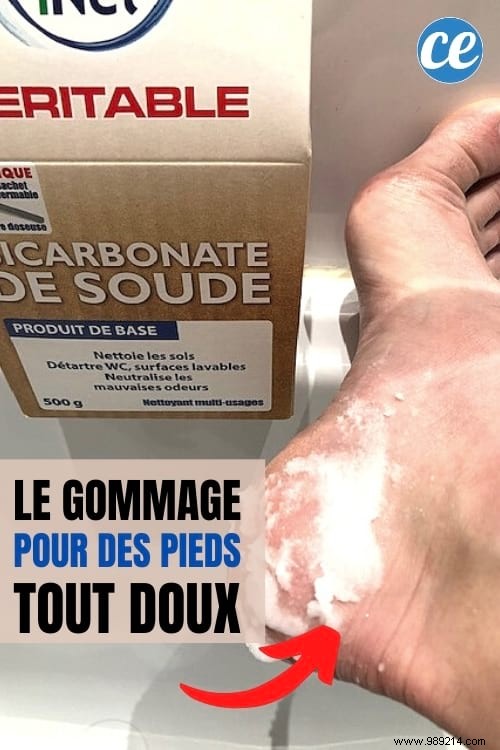 Achieve Baby-Soft Feet with This Proven Baking Soda Treatment