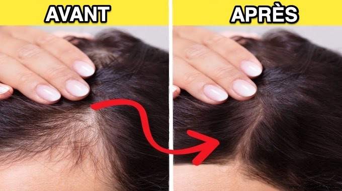 10 Proven Natural Remedies to Regrow and Strengthen Thinning Hair