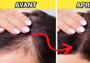 10 Proven Natural Remedies to Regrow and Strengthen Thinning Hair